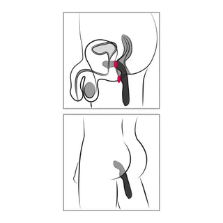 Prostata Vibrator schwarz